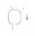 Fig. 08 - Gastroduodenal artery neuromodulation