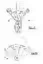 Fig. 09 - Bi-Cruciate Knee System