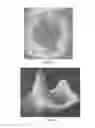 Fig. 05 - Joint arthroplasty devices and surgical tools