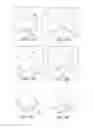 Fig. 16 - Joint arthroplasty devices and surgical tools