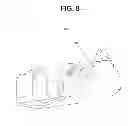 Fig. 09 - Patient specific implant positioning