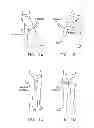 Fig. 02 - Method and apparatus for distracting a joint