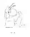 Fig. 09 - Method and apparatus for distracting a joint