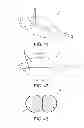 Fig. 45 - Method and apparatus for distracting a joint