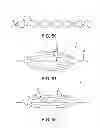 Fig. 49 - Method and apparatus for distracting a joint