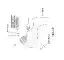 Fig. 72 - Method and apparatus for distracting a joint