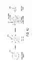 Fig. 85 - Method and apparatus for distracting a joint