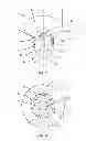 Fig. 03 - SURGICAL IMPLANT SYSTEM AND METHOD