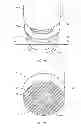 Fig. 07 - SURGICAL IMPLANT SYSTEM AND METHOD