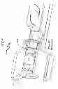 Fig. 06 - Preloaded intraocular lens (IOL) system and method