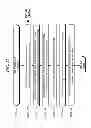 Fig. 63 - Preloaded intraocular lens (IOL) system and method