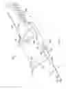 Fig. 02 - Intraocular lens surgical system and method