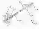 Fig. 01 - Device for retrieving a body from a tubular structure