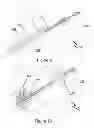 Fig. 06 - Device for retrieving a body from a tubular structure