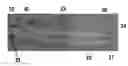 Fig. 01 - Spinal cord stimulation system