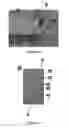 Fig. 02 - Spinal cord stimulation system