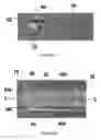 Fig. 04 - Spinal cord stimulation system