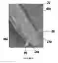 Fig. 06 - Spinal cord stimulation system