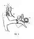 Fig. 02 - Cochlear implant with improved electrode array and controller