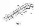Fig. 07 - Cochlear implant with improved electrode array and controller