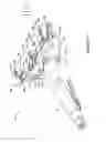 Fig. 07 - Dermatome blade assembly guard