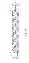 Fig. 08 - System and method for treating biological vessels