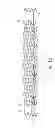 Fig. 09 - System and method for treating biological vessels