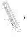 Fig. 22 - Compact endoscopic surgical blade assembly and method of use thereof