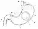 Fig. 01 - INTRAGASTRIC BALLOON SHELL MATERIALS AND CONSTRUCTION
