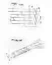 Fig. 10 - Vessel filter