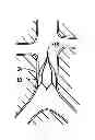 Fig. 01 - Vessel filter