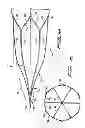 Fig. 04 - Vessel filter
