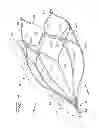 Fig. 07 - Vessel filter