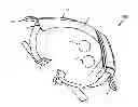 Fig. 01 - Therapy Wrap Device For Applying Pressure To Sciatic-Pain Trigger Points