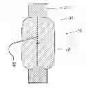 Fig. 01 - Device and method for closure of a body lumen
