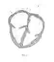 Fig. 02 - Closure device