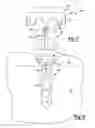 Fig. 07 - Fixation device for delivery of biological material between soft tissue and bone
