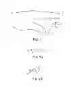 Fig. 07 - Digital fixation method of implanting a support in a patient