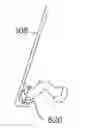 Fig. 01 - PERCUTANEOUS FACET FIXATION SYSTEM