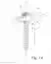 Fig. 02 - Adjustable bone screw assembly