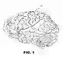 Fig. 02 - Methods and systems for treating seizures caused by brain stimulation