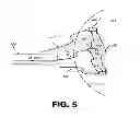 Fig. 08 - Methods and systems for treating seizures caused by brain stimulation