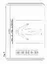 Fig. 09 - System and method of compressing medical maps for pulse generator or database storage