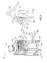 Fig. 02 - System for treating lipid-rich regions