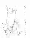 Fig. 01 - RENAL NERVE MODULATION AND ABLATION CATHETER ELECTRODE DESIGN