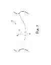 Fig. 08 - Leads incorporating a laser processed electrode