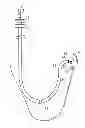 Fig. 01 - His bundle lead delivery system