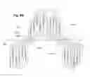 Fig. 09 - Expandable slide and lock stent