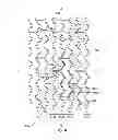 Fig. 05 - Crush Recoverable Polymer Scaffolds