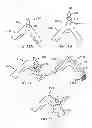 Fig. 16 - Crush Recoverable Polymer Scaffolds